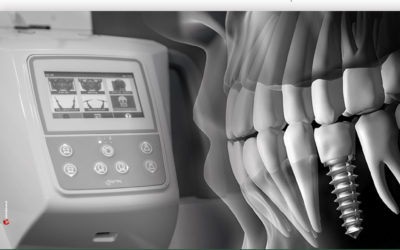 Radiologia Digitale e Diagnosi 3D